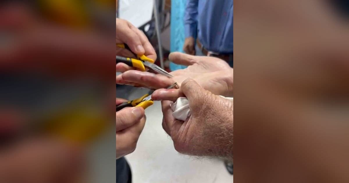 Batman'da Yaşlı Adamın Parmağında Sıkışan Yüzük Hastanede Çıkarıldı