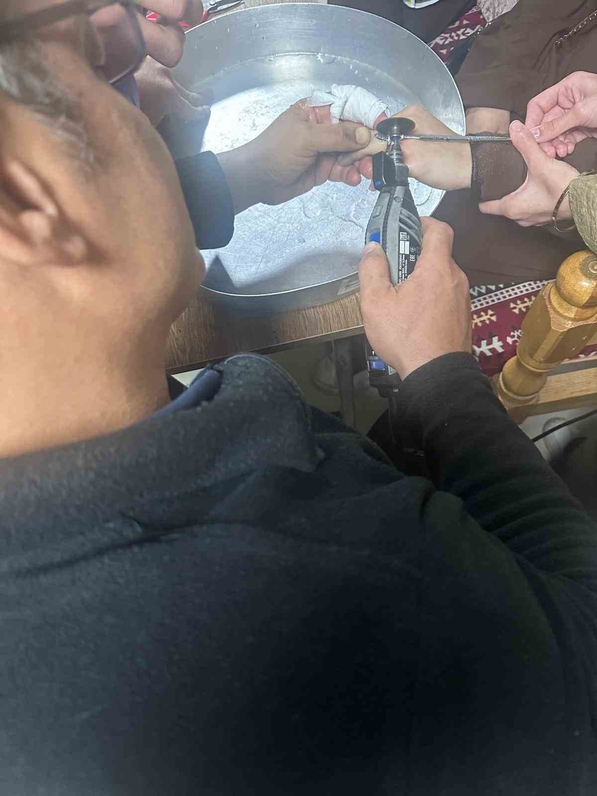 Batman’da vatandaşın parmağına sıkışan yüzük hastanede çıkarıldı